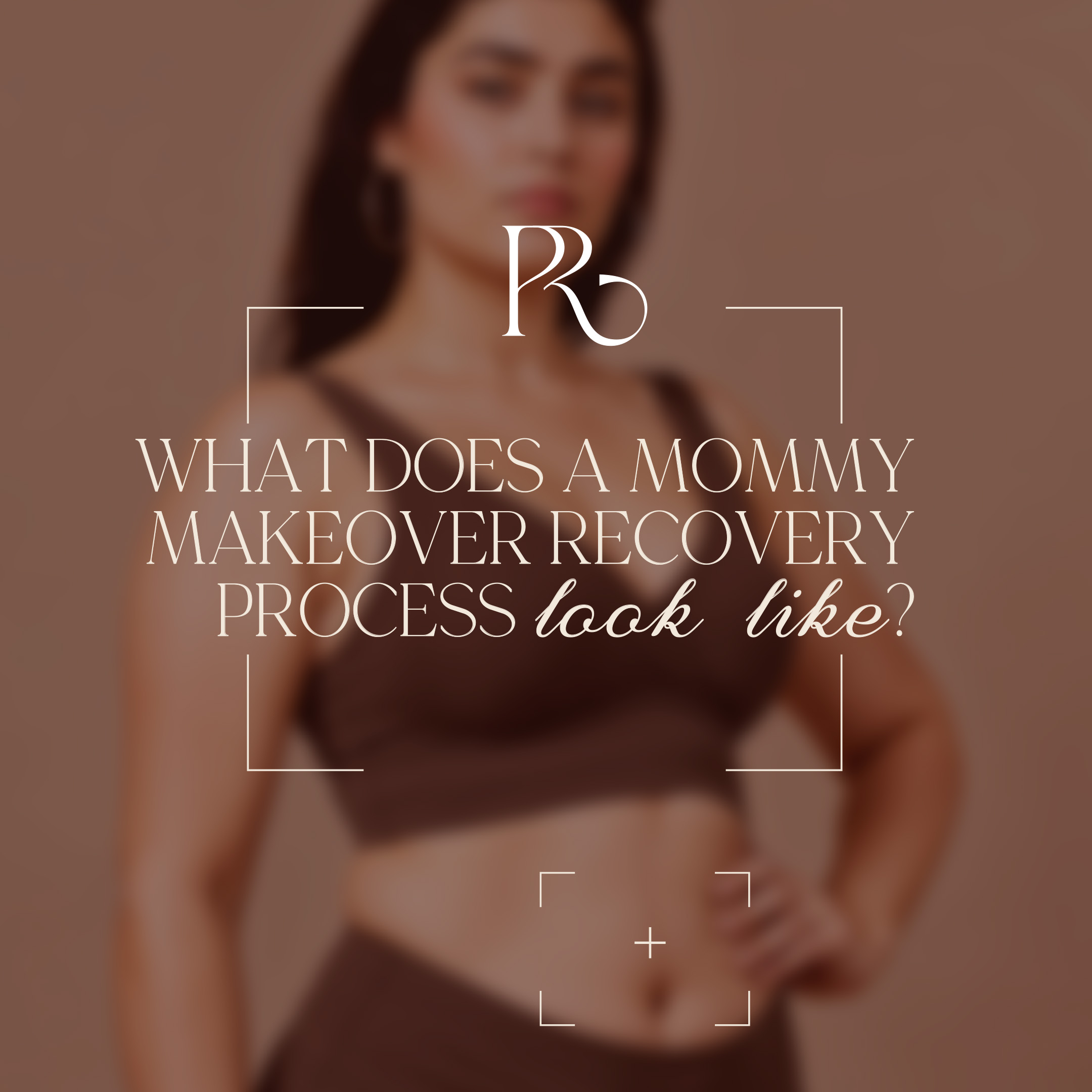 Portada del carrusel: ¿Cómo es el proceso de recuperación de un mommy makeover?